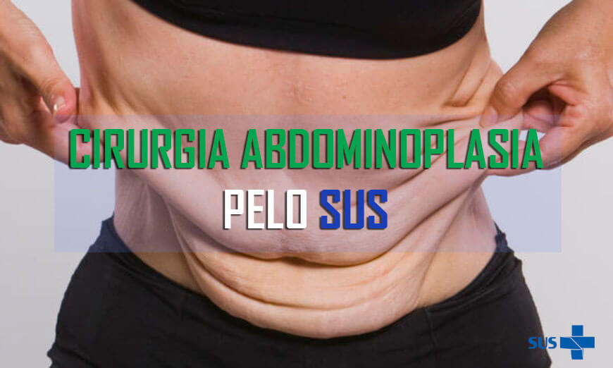 Abdominoplastia pelo SUS Veja como conseguir cirurgia plástica gratuita Vergilio Toledo